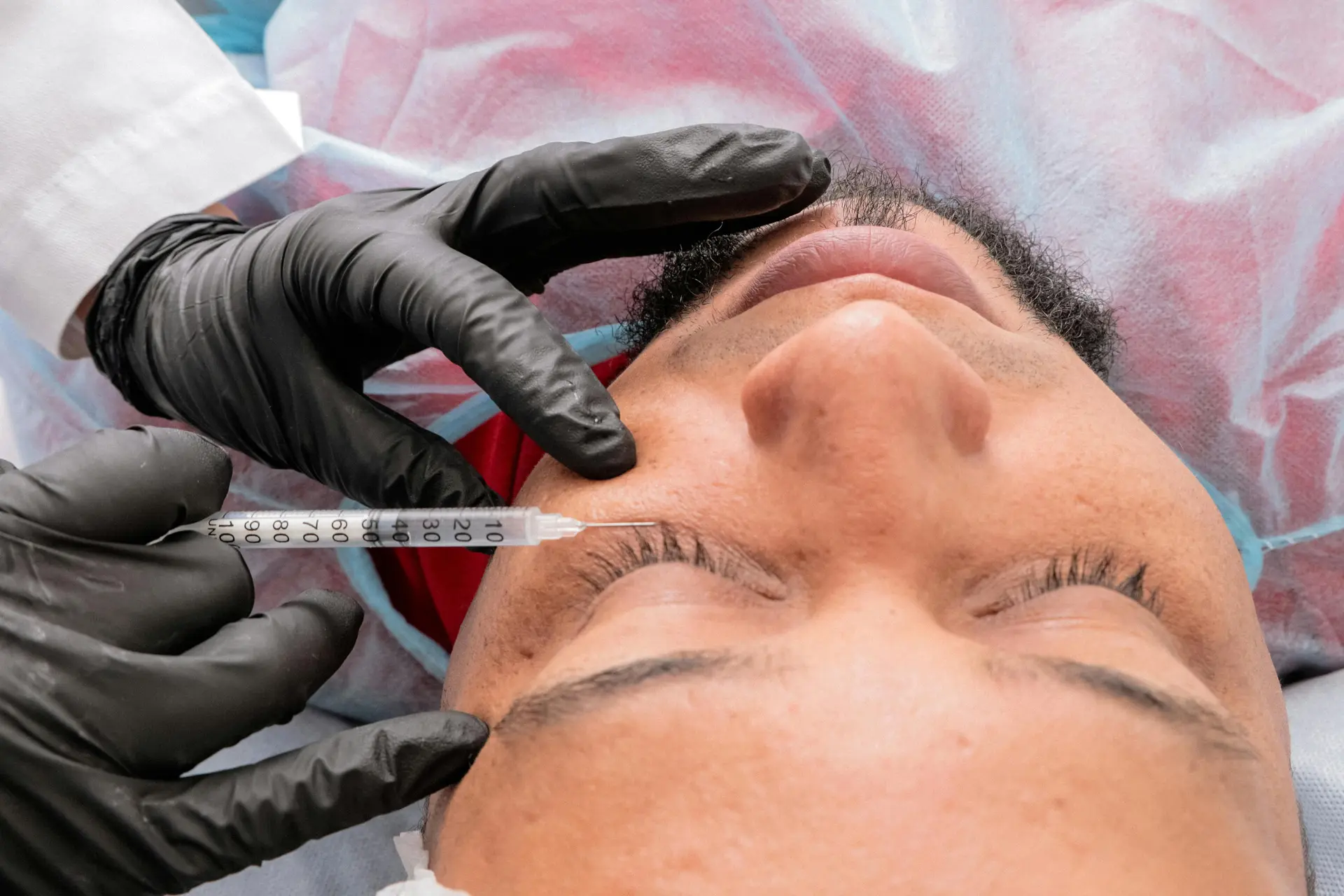 Butulotoxín (Botox)